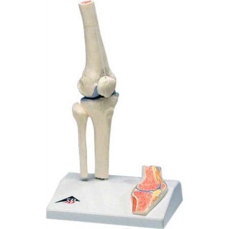 FABRICATION ENTERPRISES 3B® Anatomical Model - Mini Knee Joint with Cross Section of Bone on Base 956541